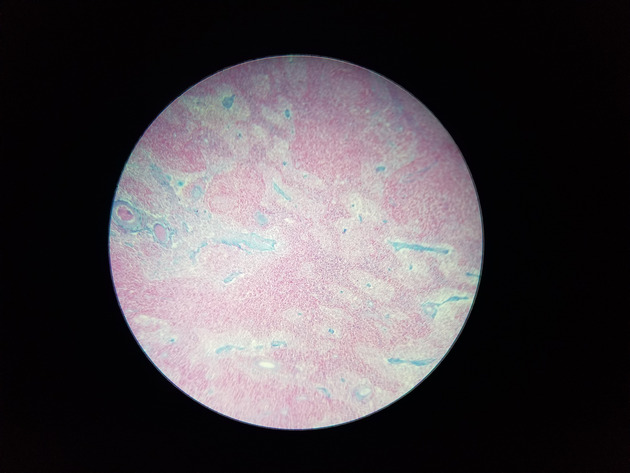 Reticular Connective Slides - Reticular Connective 02 100X